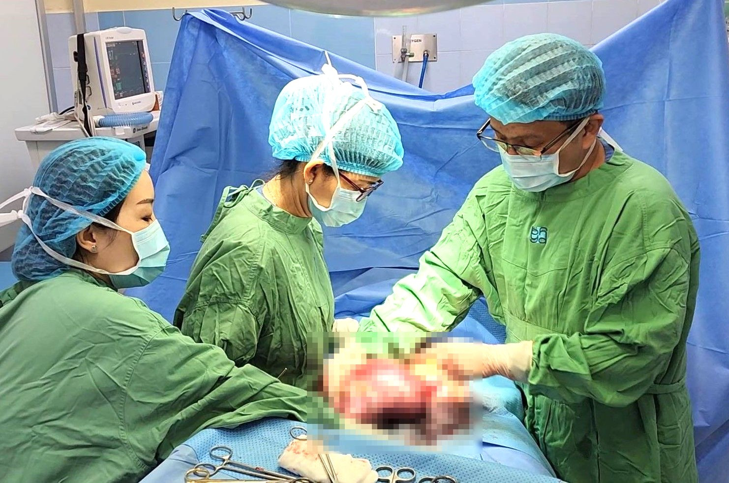 Cô gái phải mổ vì khối u xơ tử cung to như mang thai khi đi khám hiếm muộn
